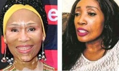 Meet Mzansi celebrities who have diseases that can not be curedMeet Mzansi celebrities who have diseases that can not be cured